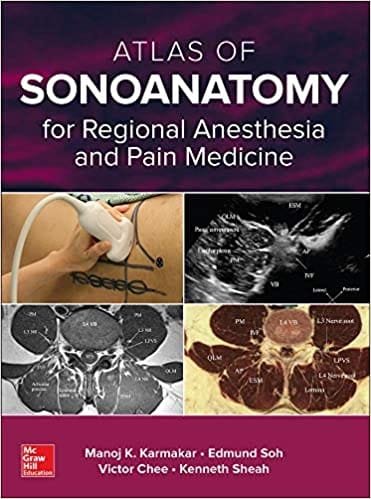 Atlas Of Sonoanatomy For Regional Anesthesia And Pain Medicine 1st edition