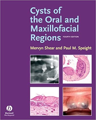 Cysts of the Oral and Maxillofacial Regions 4th Edition