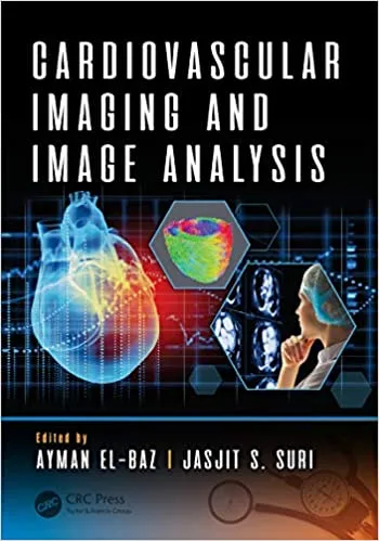 Cardiovascular Imaging and Image Analysis 1st edition