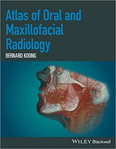 Atlas Of Oral And Maxillofacial Radiology 1st edition
