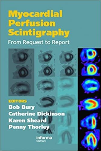 Myocardial Perfusion Scintigraphy From Request to Report 1st edition