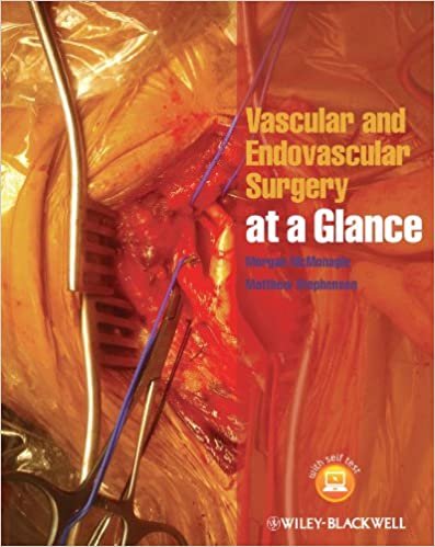 Vascular And Endovascular Surgery At A Glance 1st edition