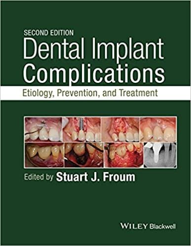 Dental Implant Complications Etiology Prevention And Treatment 2nd edition