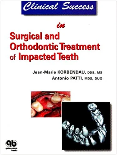 Clinical Success in Surgical And Orthodontic Treatment of Impacted Teeth 1st edition
