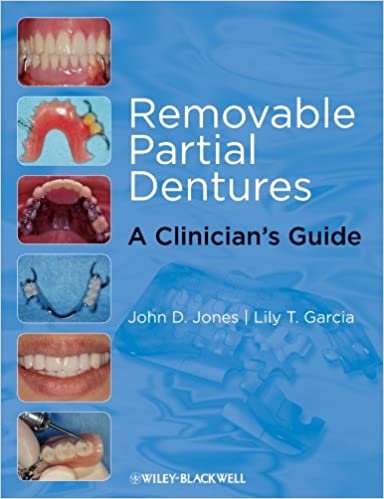 Removable Partial Dentures A Clinicians Guide 1st edition