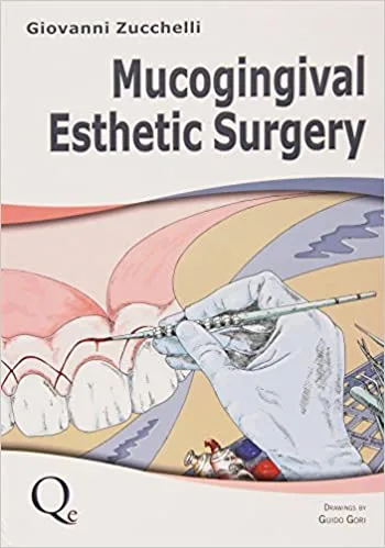Mucogingival Esthetic Surgery 2 Vol Set 1st edition