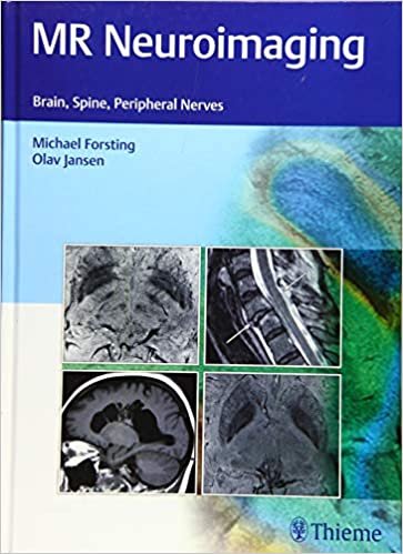 MR Neuroimaging Brain Spine Peripheral Nerves