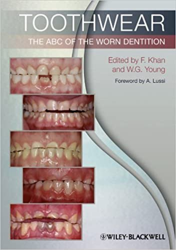 Toothwear The ABC Of The Worn Dentition 1st edition