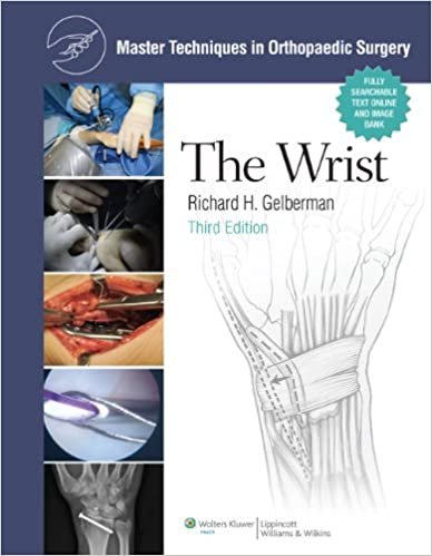 Master Techniques in Orthopaedic Surgery The Wrist 3rd Ed