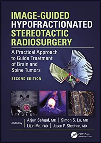 Image Guided Hypofractionated Stereotactic Radiosurgery A Practical Approach to Guide Treatment of Brain and Spine Tumors 2nd Ed