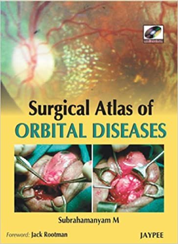 Surgical Atlas of Orbital Diseases