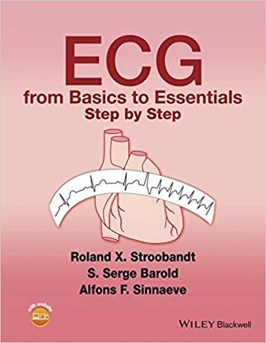 ECG from Basics to Essentials Step by Step