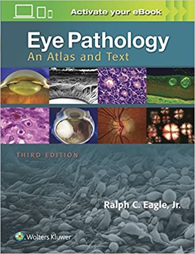 Eye Pathology An Atlas and Text 3rd edition