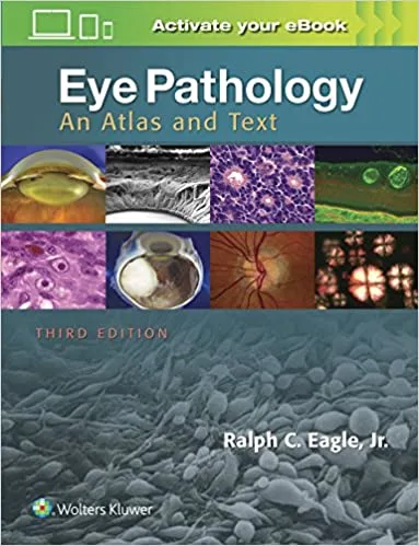 Eye Pathology An Atlas and Text 3rd edition