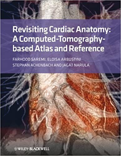 Revisiting Cardiac Anatomy A Computed Tomography Based Atlas and Reference 1st edition