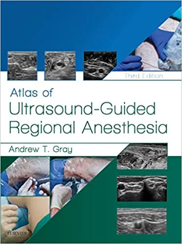 Atlas of Ultrasound Guided Regional Anesthesia 3rd edition
