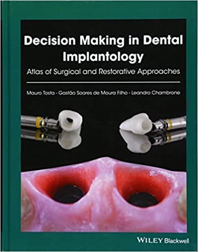 Decision Making in Dental Implantology Atlas of Surgical and Restorative Approaches 1st edition