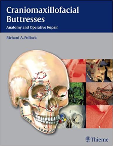 Craniomaxillofacial Buttresses Anatomy and Operative Repair 1st edition