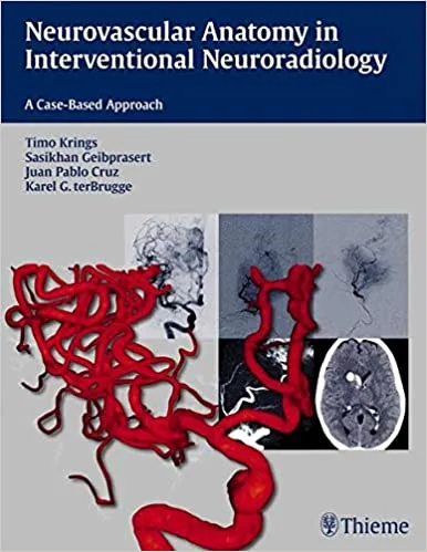 Neurovascular Anatomy in Interventional Neuroradiology A Case Based Approach 1st edition