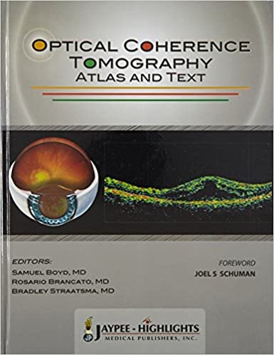 Optical Coherence Tomography Atlas and Text