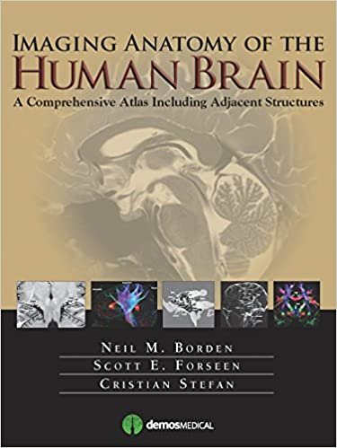 Imaging Anatomy of the Human Brain A Comprehensive Atlas Including Adjacent Structures 1st edition