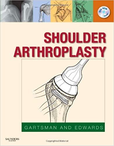 Shoulder Arthroplasty