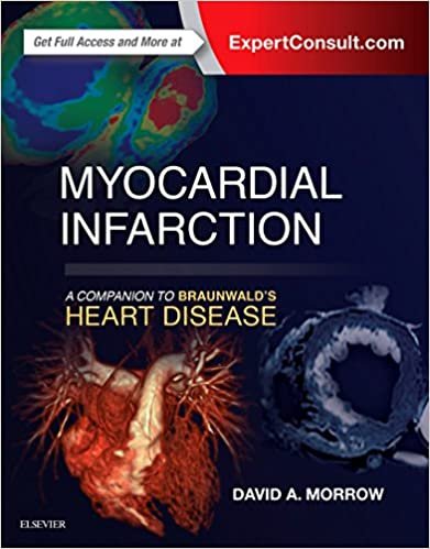 Myocardial Infarction A Companion to Braunwalds Heart Disease 1st edition