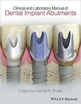 Clinical And Laboratory Manual Of Dental Implant Abutments 1st edition