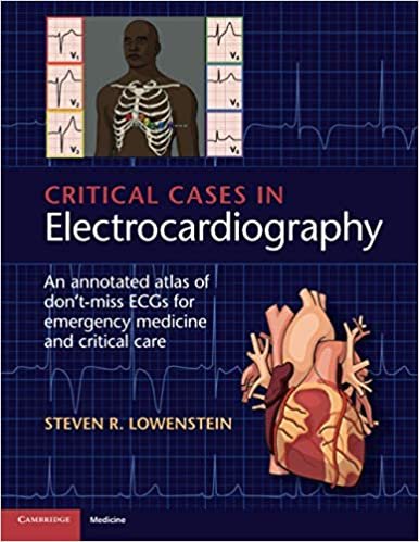 Critical Cases in Electrocardiography An Annotated Atlas of Dont Miss ECGs for Emergency Medicine and Critical Care 1st edition