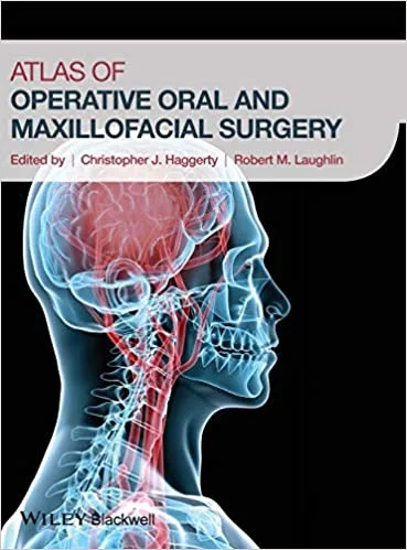 Atlas of Operative Oral and Maxillofacial Surgery 2nd edition