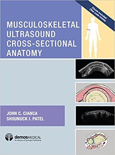 Musculoskeletal Ultrasound Cross Sectional Anatomy 1st edition