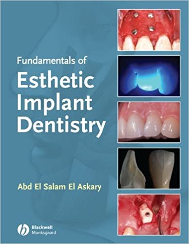 Fundamentals of Esthetic Implant Dentistry 2nd edition