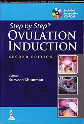 Step by Step Ovulation Induction 2nd Edition