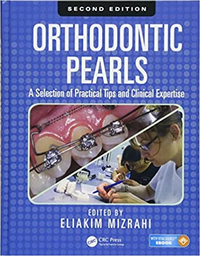 Orthodontic Pearls A Selection of Practical Tips and Clinical Expertise 2nd Edition