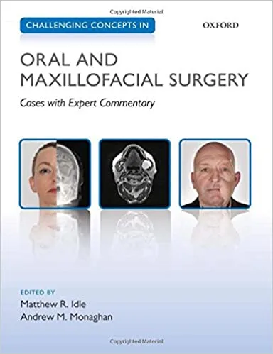 Challenging Concepts in Oral and Maxillofacial Surgery Cases with Expert Commentary 1st edition