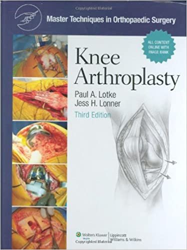 Master Techniques in Orthopaedic Surgery Knee Arthroplasty 3rd Ed