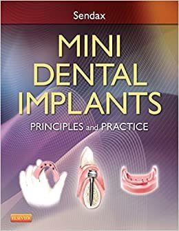 Mini Dental Implants Principles And Practice 1st edition