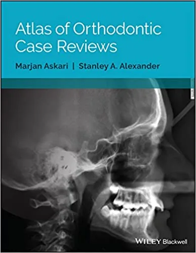 Atlas of Orthodontic Case Reviews 1st edition