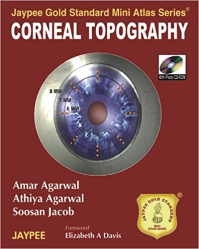 Jaypee Gold Standard Mini Atlas Series Corneal Topography