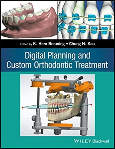 Digital Planning and Custom Orthodontic Treatment 1st edition