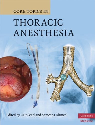 Core Topics in Thoracic Anesthesia 1st edition