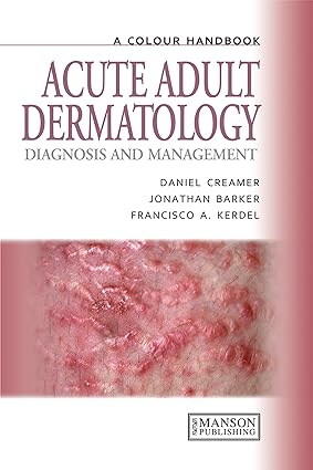 A Colour Handbook Acute Adult Dermatology Diagnosis and Management 1st edition
