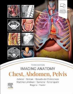 Imaging Anatomy Chest Abdomen Pelvis 3rd edition