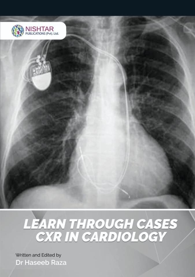 Learn Through Cases CXR In cardiology By Dr Haseeb Raza