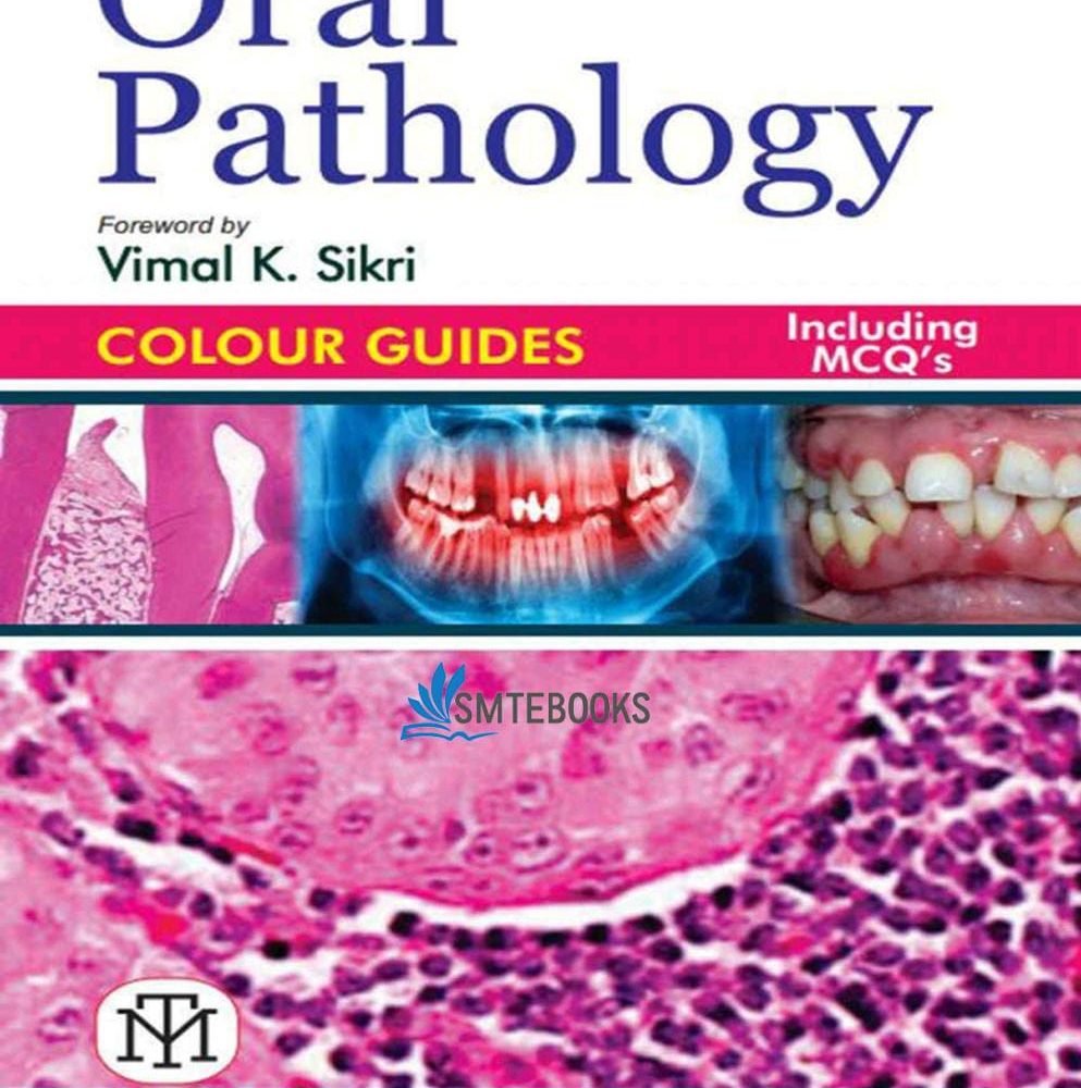 Oral Pathology Colour Guides By Arpit Sikri