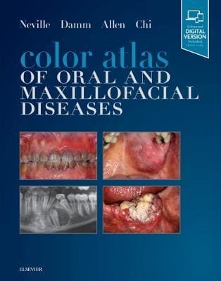 Color Atlas of Oral and Maxillofacial Diseases 1st edition