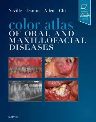 Color Atlas of Oral and Maxillofacial Diseases 1st edition