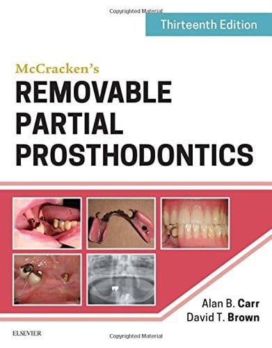 McCrackens Removable Partial Prosthodontics 13th edition