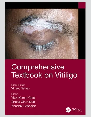 Comprehensive Textbook on Vitiligo 1st edition