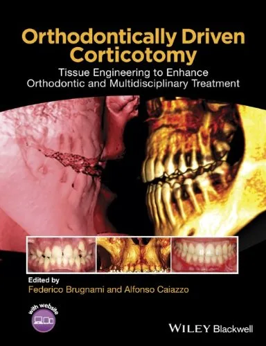 Orthodontically Driven Corticotomy Tissue Engineering to Enhance Orthodontic and Multidisciplinary Treatment 1st edition